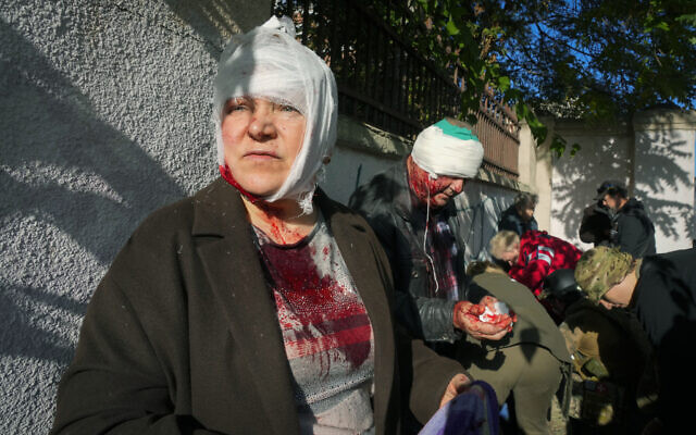 People receive medical treatment at the scene of Russian strikes on Kyiv, Ukraine, October 10, 2022. (AP Photo/Efrem Lukatsky)