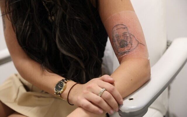 Client Kimberly sits at NAAMA Studios, a tattoo removal clinic in Marylebone, London, on December 14, 2022, shows her tattoo picturing US singer Kanye West (Isabel INFANTES / AFP) Client Kimberly sits at NAAMA Studios, a tattoo removal clinic in Marylebone, London, on December 14, 2022, shows her tattoo picturing US singer Kanye West (Isabel INFANTES / AFP)