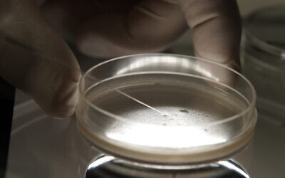 Illustrative:  A researcher examines human embryonic stem cells with a microscope in Michigan, October 22, 2008.  (Paul Sancya/AP)