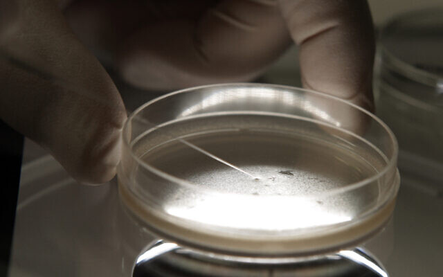 Illustrative: A researcher examines human embryonic stem cells with a microscope in Michigan, October 22, 2008. (Paul Sancya/AP) Illustrative: A researcher examines human embryonic stem cells with a microscope in Michigan, October 22, 2008. (Paul Sancya/AP)