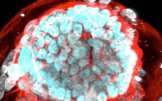 Digital imagery of stem cell-derived embryos created by scientists at the Weizmann Institute of Science in June 2023. (Screen capture/Weizmann Institute of Science) Digital imagery of stem cell-derived embryos created by scientists at the Weizmann Institute of Science in June 2023. (Screen capture/Weizmann Institute of Science)