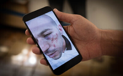 A man at the Jerusalem Magistrate's Court on August 20, 2023, shows a picture of Arwah Sheikh Ali, who alleges police branded him with a Star of David while he was arrested in East Jerusalem's Shuafat refugee camp. (Chaim Goldberg/Flash90)