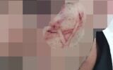 A Palestinian allegedly branded by Israel Police officers on August 18, 2023. (Courtesy)