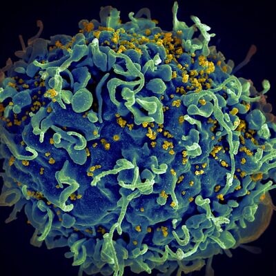 HIV virus (yellow) infecting a human cell (© Photo by National Cancer Institute on Unsplash/Courtesy of Touro University)