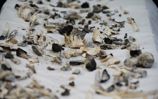 Charred bone shards are all that remain of some of the victims of the mass murderous attack by Hamas on southern Israeli communities on October 7, 2023. Scientists and anthropologists examine and try to extract DNA from them for identification purposes at the National Center of Forensic Medicine (Abu Kabir) in Jaffa, October 16, 2023. (Tomer Neuberg/Flash90)