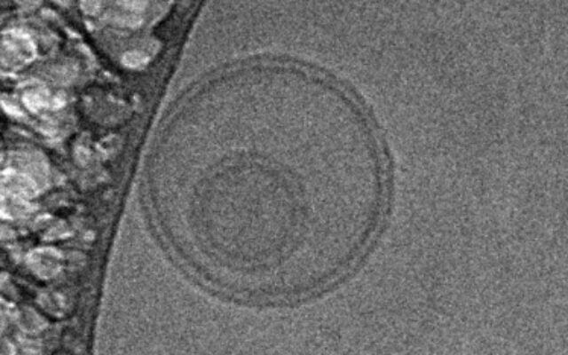 Image of two small extracellular vesicles (sEVs), one on top of the other, captured using cryogenic electron microscopy. The double-layer membrane, a hallmark of sEVs, is clearly visible. (Leor's lab, Neufeld and Tamman Cardiovascular Research Institutes, School of Medicine, Tel Aviv University and Lev Leviev Cardiovascular and Thoracic Center, Sheba Medical Center) Image of two small extracellular vesicles (sEVs), one on top of the other, captured using cryogenic electron microscopy. The double-layer membrane, a hallmark of sEVs, is clearly visible. (Leor's lab, Neufeld and Tamman Cardiovascular Research Institutes, School of Medicine, Tel Aviv University and Lev Leviev Cardiovascular and Thoracic Center, Sheba Medical Center)
