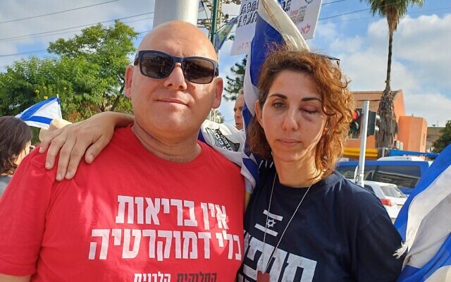 Dr. Tal Weissbach (R) who was injured by a police water cannon while volunteering as a medical professional at a protest in Jerusalem attends a demonstration against police brutality organized by medical professionals outside Sheba Medical Center, June 19, 2024. (Courtesy, Pro-Democracy Protest Movement) Dr. Tal Weissbach (R) who was injured by a police water cannon while volunteering as a medical professional at a protest in Jerusalem attends a demonstration against police brutality organized by medical professionals outside Sheba Medical Center, June 19, 2024. (Courtesy, Pro-Democracy Protest Movement)