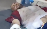 Amin Abed, 35, a Gazan critic of Hamas, is seen on a stretcher after an assault by masked men with knives and batons, July 8, 2024. (Screen capture via X, used in accordance with Clause 27a of the Copyright Law)