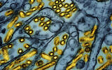 This colorized electron microscope image released by the National Institute of Allergy and Infectious Diseases on March 26, 2024, shows avian influenza A H5N1 virus particles (yellow), grown in Madin-Darby Canine Kidney (MDCK) epithelial cells (blue). (CDC/NIAID via AP)