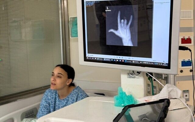 Freed hostage Emily Damari being prepped for surgery a Sheba Medical Center on March 2, 2025 on her left hand, after being shot on October 7, 2023 and not given proper medical care during 15 months of Hamas captivity in Gaza (Credit Pomi Ofi Tal)