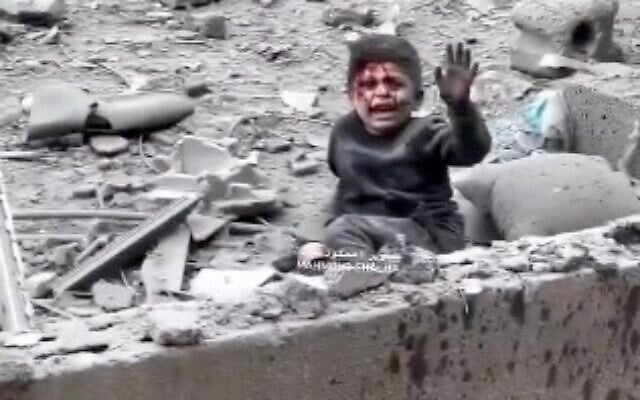 A child injured in a reported Israeli airstrike in Gaza on April 24, 2025. (Screen capture/X)