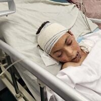 A wounded Palestinian child, the only surviving child of doctor Alaa al-Najjar, lies in a hospital bed at Nasser Hospital in Khan Younis after an Israeli airstrike on May 23, 2025, allegedly hit their home. Al-Najjar lost 9 of her 10 children in the attack, which occurred shortly after she had left for work. (Hani Alshaer / Anadolu via Reuters)