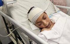 A wounded Palestinian child, the only surviving child of doctor Alaa al-Najjar, lies in a hospital bed at Nasser Hospital in Khan Younis after an airstrike allegedly hit their home. Al-Najjar lost 9 of her 10 children in the attack, which occurred shortly after she had left for work. (Hani Alshaer / Anadolu via Reuters)