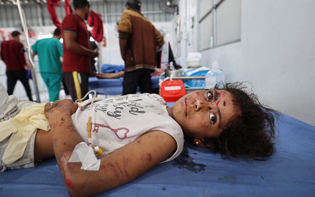 A wounded girl receives treatment at Al-Awda Hospital at the Nuseirat refugee camp in the central Gaza Strip, following an Israeli airstrike on May 19, 2025. (Eyad BABA / AFP)