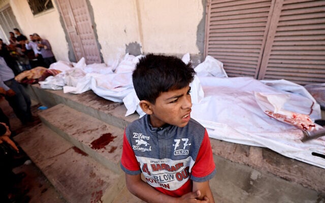 A boy gestures as he stands near the bodies of Palestinians killed in Israeli strikes, at the al-Aqsa Martyrs hospital in Deir el-Balah in the central Gaza Strip on May 20, 2025.  (Photo by Eyad BABA / AFP)