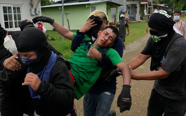 Men carry a fellow demonstrator injured during clashes with police at a protest against recent actions by President Jose Raul Mulino, including a pension reform law and a security agreement with the United States involving the Panama Canal, in Arimae, Panama,June 5, 2025. (AP Photo/Matias Delacroix) Men carry a fellow demonstrator injured during clashes with police at a protest against recent actions by President Jose Raul Mulino, including a pension reform law and a security agreement with the United States involving the Panama Canal, in Arimae, Panama,June 5, 2025. (AP Photo/Matias Delacroix)
