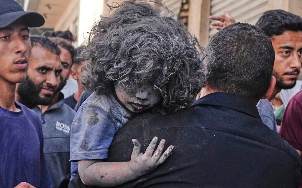 A Palestinian man carries a wounded child after an Israeli strike on a residential building in Gaza City, Friday, June 27, 2025. (AP Photo/Jehad Alshrafi)