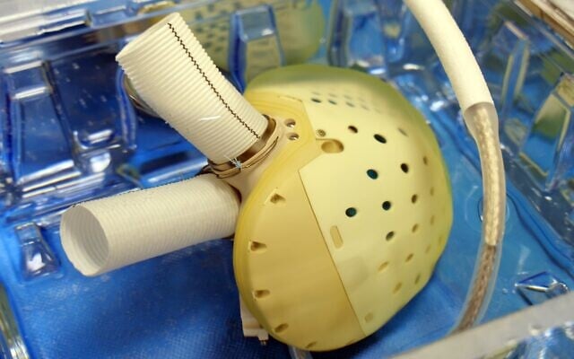 The Carmat Aeson artificial heart. (Courtesy)