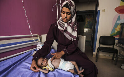 A malnourished child is seen along with his mother at the Al-Rantisi Children's Hospital in Gaza City, Gaza on July 24, 2025. (Mahmoud Issa / Anadolu via Reuters)