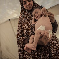 Seven-month-old Salim Mahmoud Awad suffers significant weight loss due to the lack of baby formula and food after being displaced to Gaza City, Gaza with his family, on July 26, 2025. (Ahmed Jihad Ibrahim Al-arini/Anadolu via Reuters Connect)
