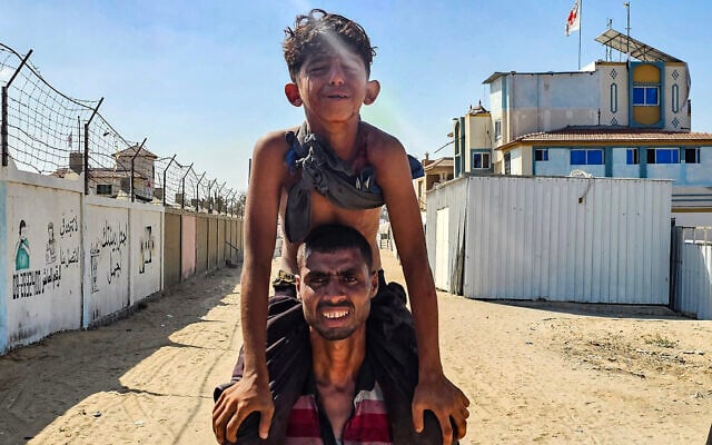 A Palestinian man transports a young victim to a Red Cross clinic in Rafah in the southern Gaza Strip after he was reportedly shot as he waited to receive food parcels at a distribution point run by the US- and Israel-backed Gaza Humanitarian Foundation, on July 12, 2025. (AFP)