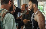A Druze Syrian man, wounded in the latest rounds of fighting, is surrounded by friends and family members following the withdrawal of government forces from Syria's southern Sweida city on July 17, 2025. (Shadi AL-DUBAISI / AFP)
