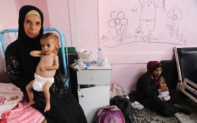 Najah (L), a 35-year-old Palestinian mother, carries her malnourished 11-month-old daughter Sila as they await treatment at Nasser Hospital in Khan Younis in the southern Gaza Strip on July 24, 2025. (AFP)