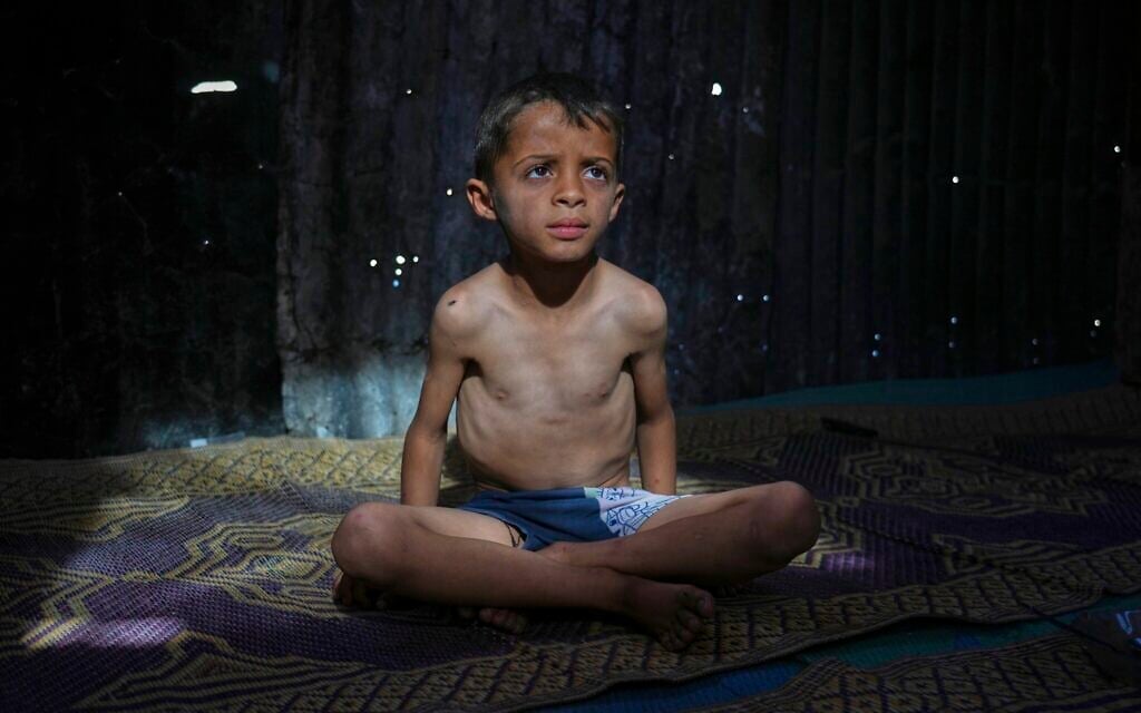 Israel said hampering entry of baby formula into Gaza as child malnutrition climbs