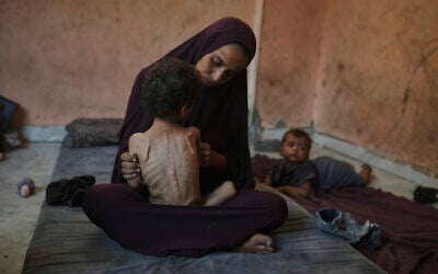 Naima Abu Ful holds her malnourished 2-year-old child, Yazan, at their home in the Shati refugee camp in Gaza City on July 23, 2025. (AP Photo/Jehad Alshrafi)