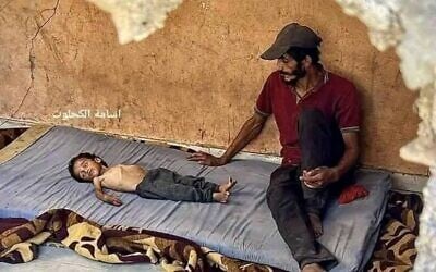 14-year-old Abdul Qader al-Fayoumi, in a photograph that the Defense Ministry's COGAT posted online on July 31, 2025. COGAT said reports that he died of starvation in Gaza were misleading, saying the teen suffered from a genetic neurological disorder and was treated in Israel in 2018. (X, via COGAT; used in accordance with clause 27a of the copyright law)