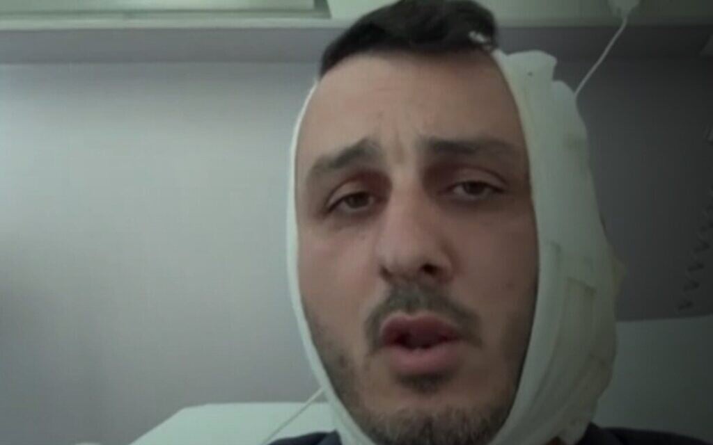 Israeli says man screamed ‘F*ck Israel, I’m Hamas,’ bit part of his ear off in Greece