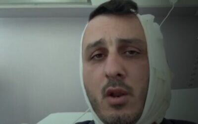 Stav Ben-Shushan, who said a man bit part of his ear off after shouting anti-Israel slogans, on July 26, 2025 in Athens. (Channel 12 screenshot) Stav Ben-Shushan, who said a man bit part of his ear off after shouting anti-Israel slogans, on July 26, 2025 in Athens. (Channel 12 screenshot)