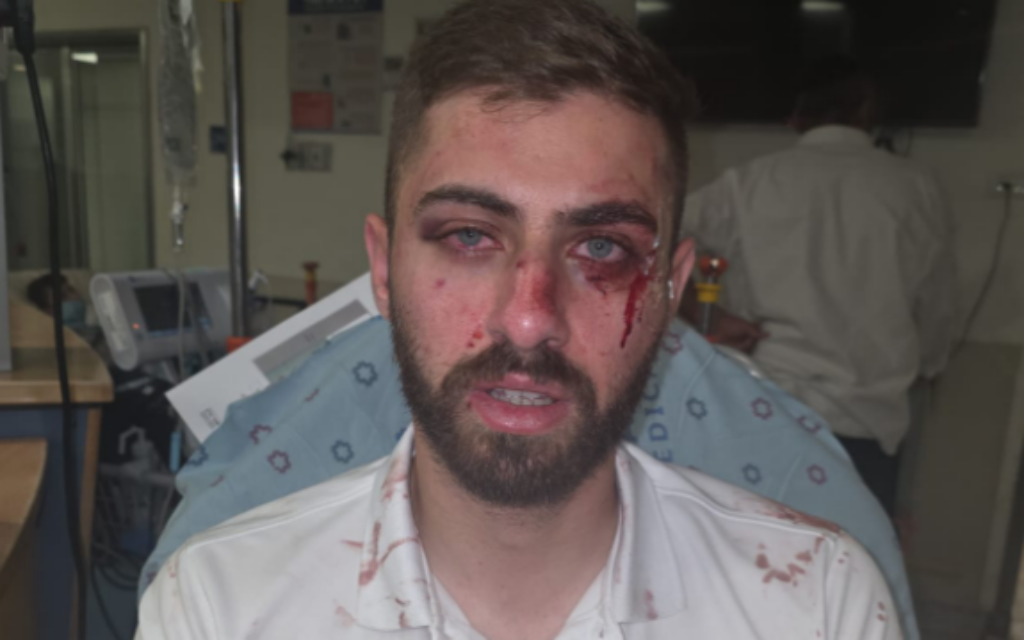 Arab bus driver injured in assault by group of teens in Jerusalem