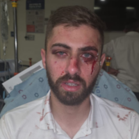 Jerusalem bus driver Ahmad Shehadeh, pictured in the hospital after he was attacked and robbed by three teenagers early in the morning on July 15, 2025. (Courtesy/Bus Driver's Association)