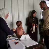 A malnourished Palestinian child gets a check up at a medical point run by a local NGO affiliated with the primary health care of the Palestinian health ministry in al-Mawasi, in the southern Gaza Strip district, on August 13, 2025. (Photo by AFP)