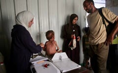 A malnourished Palestinian child gets a check up at a medical point run by a local NGO affiliated with the primary health care of the Palestinian health ministry in al-Mawasi, in the southern Gaza Strip district, on August 13, 2025. (Photo by AFP)
