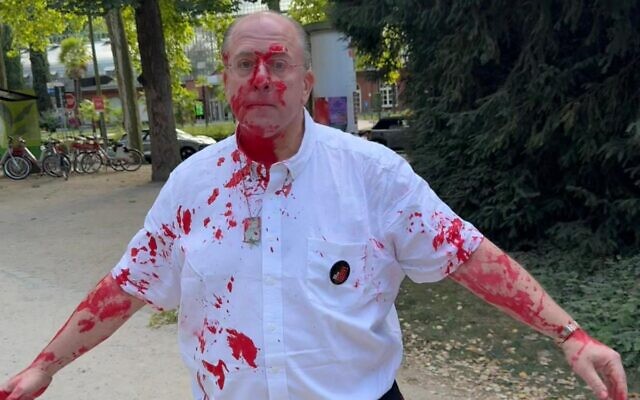Illustrative: Sacha Stawski, a member of the Jewish community who was attacked with red paint, along with other activists, as they hung hostage posters in a park on August 23, 2025 in Frankfurt, Germany. (Image from X) Illustrative: Sacha Stawski, a member of the Jewish community who was attacked with red paint, along with other activists, as they hung hostage posters in a park on August 23, 2025 in Frankfurt, Germany. (Image from X)