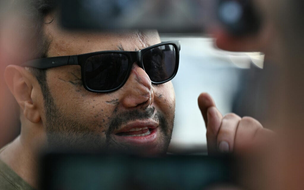 A man who was wounded in an Israeli operation in Lebanon that detonated hundreds of pagers and walkie-talkies used by Hezbollah, attends in a gathering in Beirut on September 17, 2025, to mark the one year anniversary of the Israeli operation. (Photo by Joseph EID / AFP) A man who was wounded in an Israeli operation in Lebanon that detonated hundreds of pagers and walkie-talkies used by Hezbollah, attends in a gathering in Beirut on September 17, 2025, to mark the one year anniversary of the Israeli operation. (Photo by Joseph EID / AFP)