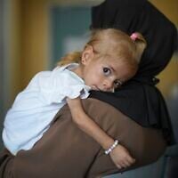Islam Qudeih holds her daughter, Shamm Qudeih, 2, during an interview with The Associated Press at the Santobono Pausilipon Children's Hospital in Naples, southern Italy, Tuesday, Sept. 2, 2025, where Shamm is being treated after being evacuated from Gaza. (AP Photo/Andrew Medichini)