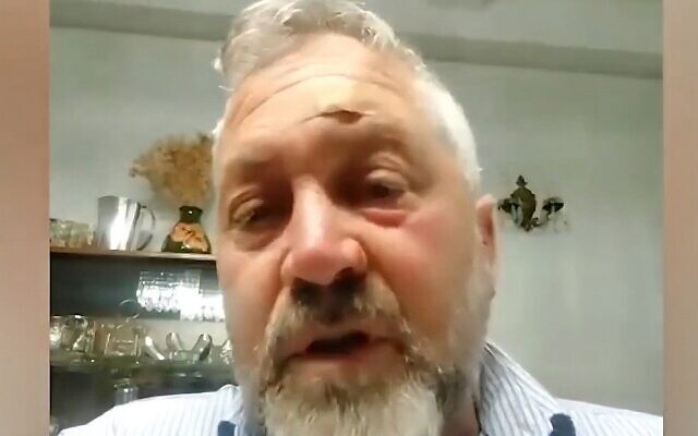 Rami Glickstein, victim of an antisemitic assault in New York on October 27, 2025,, speaks to Channel 7. (Screenshot via X)