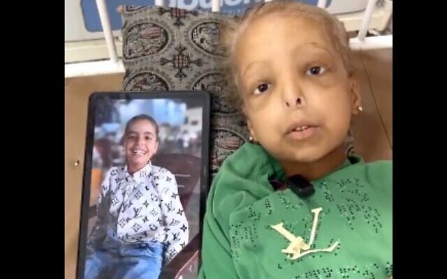 Huda Abu Najah lays in bed on October 8, 2025, next to a photo of her before she began suffering from severe malnutrition. (Screen capture/X)