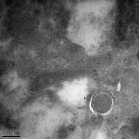 A bacterial cell (elongated shape in the center) inside a glioblastoma tumor cell, as seen through an electron microscope. The black dots within the bacterium are engineered antibodies carrying gold particles that bind specifically to a component found only in bacterial cell envelopes and not in human cells. (Courtesy/Weizmann Institute of Science)