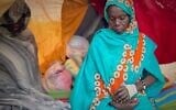 An injured Sudanese woman who fled el-Fasher city, after Sudan's paramilitary forces killed hundreds of people in the western Darfur region, sits in a tent at a camp in Tawila, Sudan, Oct. 31, 2025. (AP Photo/Mohammed Bakry)