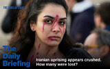 A protester has her face painted to resemble bullet holes during a rally in support of the Iranian people in Rome, January 17, 2026. (AP Photo/Gregorio Borgia)