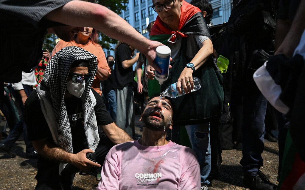 A protester is helped after police deployed pepper spray to disperse demonstrators taking part in a pro-Palestinian, anti-Israel rally against  President Isaac Herzog's visit to Australia in Sydney on February 9, 2026.  (Saeed Khan / AFP)