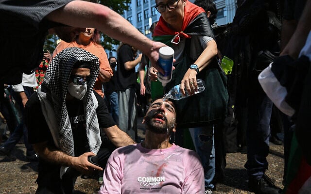 A protester is helped after police deployed pepper spray to disperse demonstrators taking part in a pro-Palestinian, anti-Israel rally against  President Isaac Herzog's visit to Australia in Sydney on February 9, 2026.  (Saeed Khan / AFP)