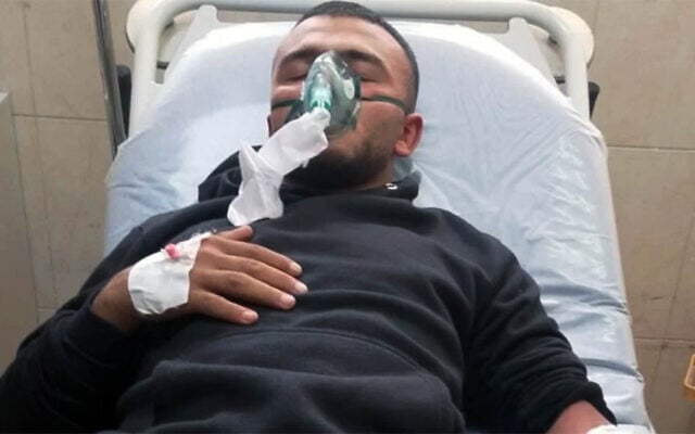 Ahmad Daraghmeh, a resident of the Palestinian West Bank village of Tayasir, who was injured by extremist settlers during an attack they staged on the dwelling on March 31, 2026. (Amer Dabak) Ahmad Daraghmeh, a resident of the Palestinian West Bank village of Tayasir, who was injured by extremist settlers during an attack they staged on the dwelling on March 31, 2026. (Amer Dabak)