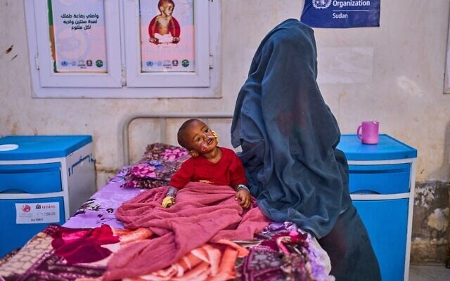 Hashem Abderaman sits in his bed next to his mother while receiving treatment at the paediatric hospital stabilization center in Port Sudan, Sudan, April 15, 2026. (AP Photo/Bernat Armangue) Hashem Abderaman sits in his bed next to his mother while receiving treatment at the paediatric hospital stabilization center in Port Sudan, Sudan, April 15, 2026. (AP Photo/Bernat Armangue)