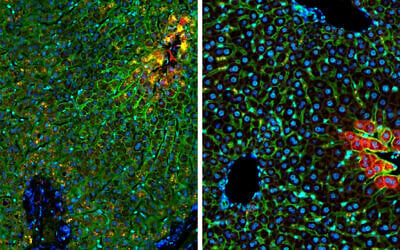 Weizmann Institute of Science researchers discovered that a glucose transporter protein (green) operates in the core of the liver lobule in humans (left), whereas in mice (right), it functions at the periphery. In red is a control protein expressed in the core in both humans and mice. In blue are cell nuclei. (Courtesy/Weizmann Institute of Science)