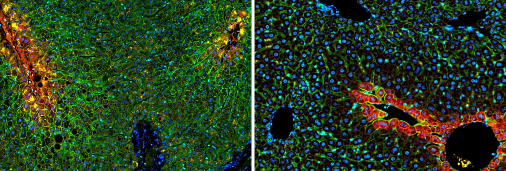 In world first, Israeli scientists map digital atlas of healthy human liver
